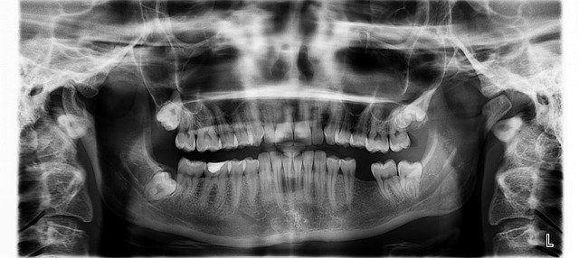 cbct